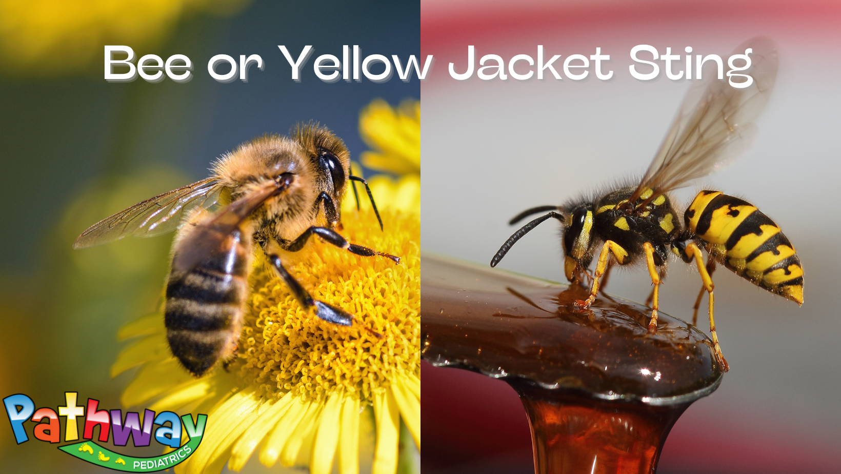 Bee or Yellow Jacket Sting