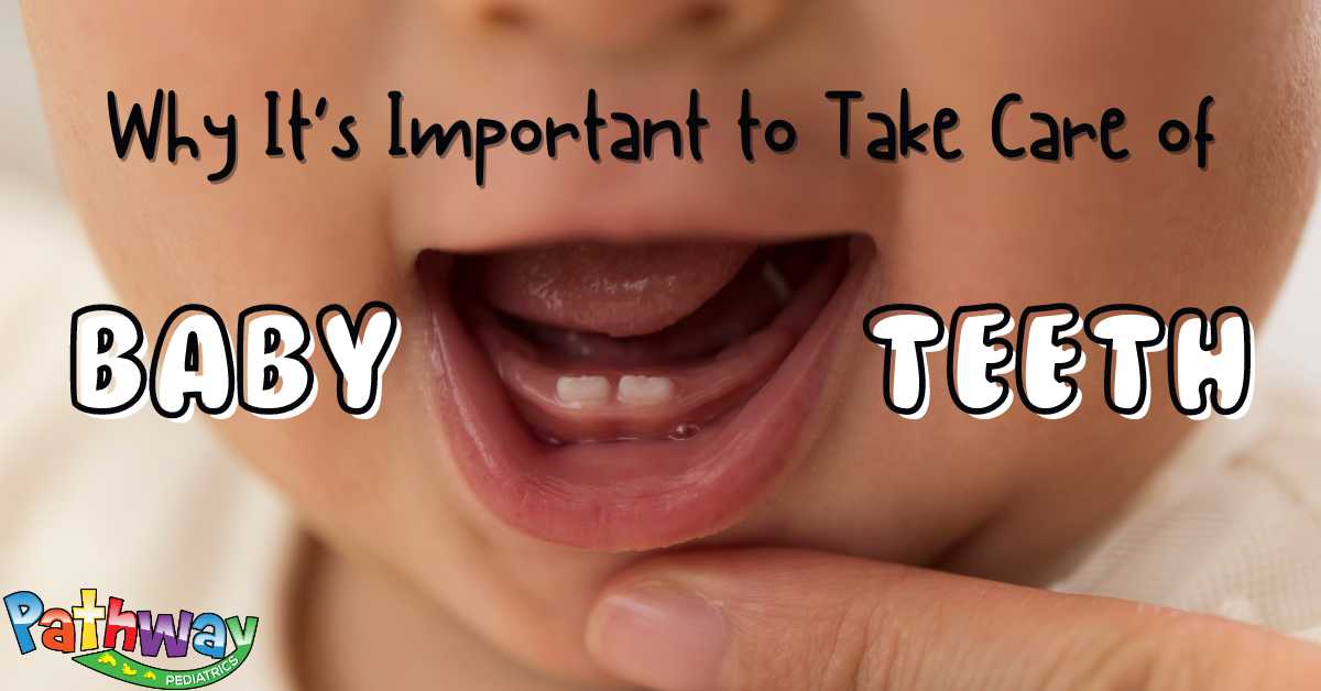 Why It’s Important to Take Care of Baby Teeth